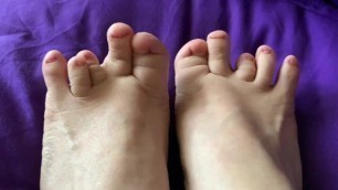 FREAKY AND UGLIEST FEET, WOULD YOU LICK THEM?